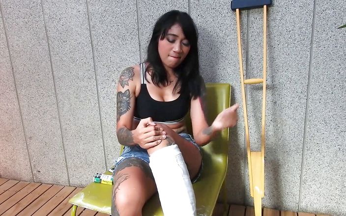 Tattooed Asian model with short cast leg