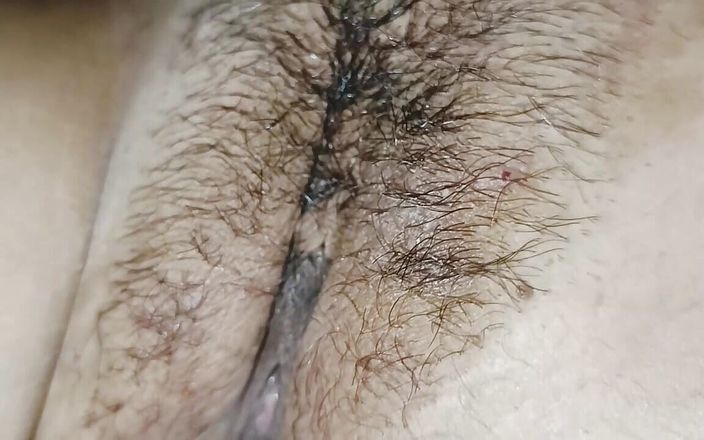 Too Much Came Out of My Finger